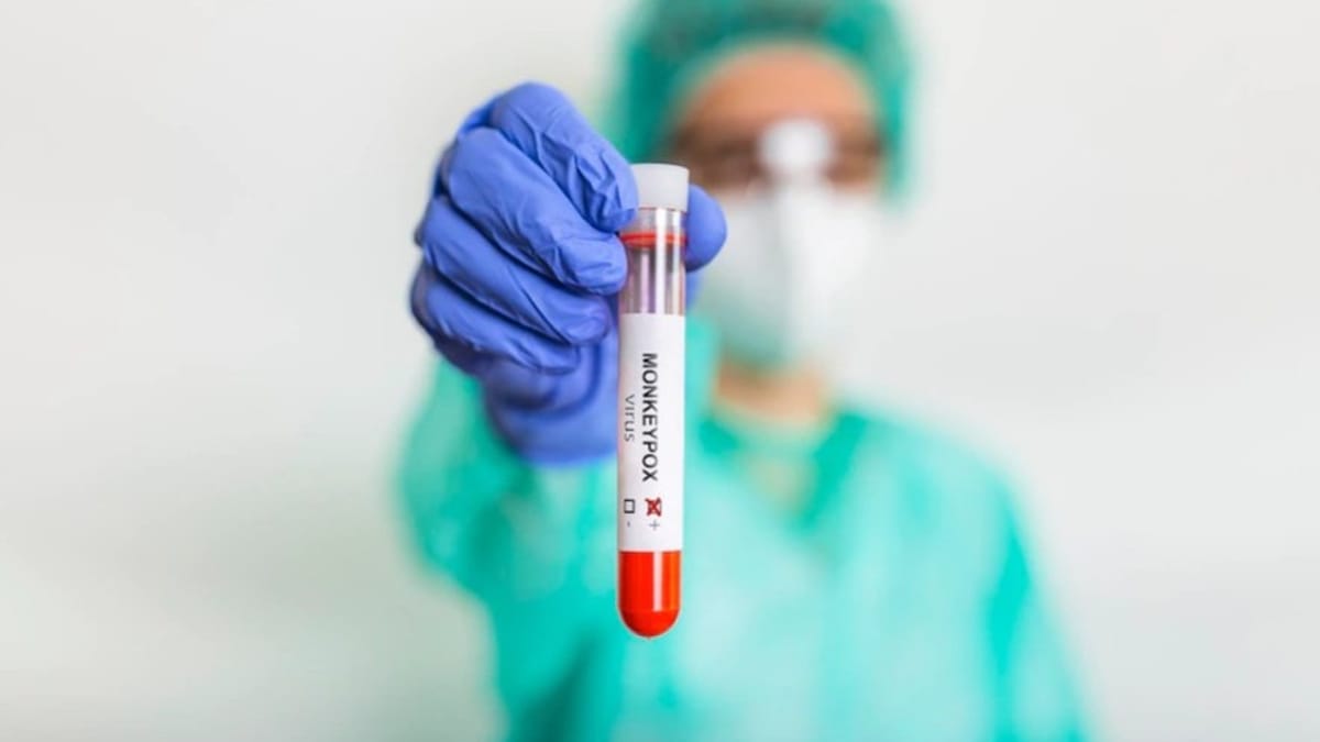 Fiocruz produz insumo para testes da varíola do macaco em tempo recorde